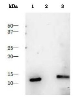 Abcam Recombinant HIV1 Protease protein, 10UG