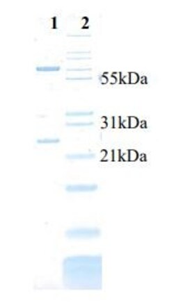 Abcam&nbsp;Native Human IgM protein, 1MG