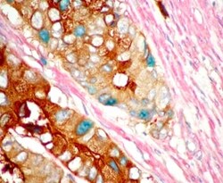 Abcam&nbsp;TripleStain IHC Kit: M&M&R on Human tissue (DAB, AP/Red & HRP/Green), 60ML