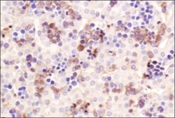 Abcam Anti-CHREBp antibody, Quantity: Each of 1