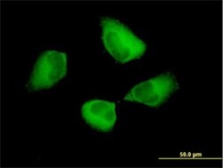 Abcam Anti-ALIX antibody, Quantity: Each of 1
