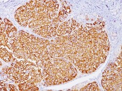 Abcam&nbsp;Anti-Melanoma antibody HMB45  M2-7C10  M2-9E3