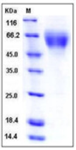 Sino Biological Recombinant Mouse DR6/TNFRSF21 Protein (His Tag), Quantity: