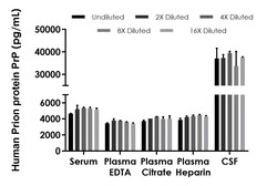 Abcam&nbsp;Human Prion protein PrP ELISA Kit, 1 x 96 Tests