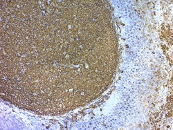 Abcam&nbsp;20 x  TBS-T with Tween 20, 125ML