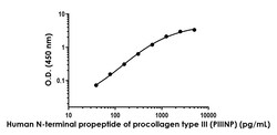 Abcam&nbsp;Human Procollagen III N-terminal propeptide (PIIINP) Antibody Pair - BSA and Azide free, 10 x 96 Tests