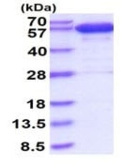 Abcam&nbsp;Recombinant human Catalase protein, 100UG
