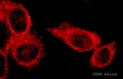 Abcam&nbsp;Donkey Anti-Rabbit IgG H&L (TRITC) preadsorbed.