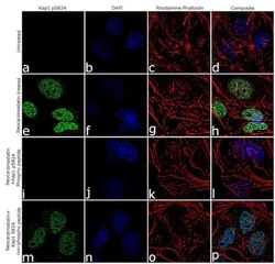 Abcam Anti-KAP1 (phosho S824) Antibody [RP23040148].