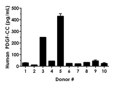 Abcam Human PDGF-CC ELISA Kit, 1 x 96 Tests