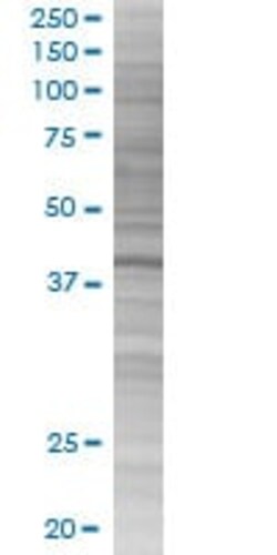 Abcam&nbsp;C13orf31 overexpression 293T lysate (whole cell).