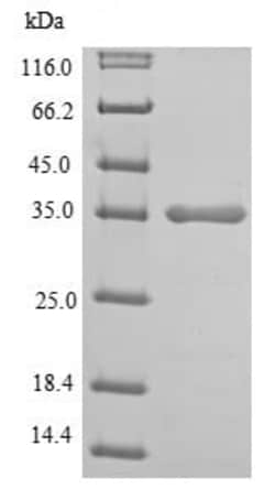 Abcam Recombinant Human Lactate Dehydrogenase protein, 100UG, Quantity: