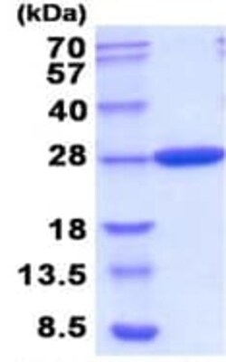 Abcam&nbsp;Recombinant E. coli Carbonic anhydrase 2/CA2 protein, 20UG