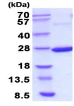 Abcam&nbsp;Recombinant E. coli Thermosensitive gluconokinase protein, 20UG