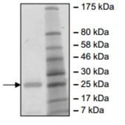 Abcam Recombinant hepatitis c virus Hepatitis C Virus NS3 + NS4A protein, 20UG