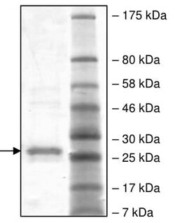 Abcam Recombinant Hepatitis C Virus Core 2a protein (Tagged).