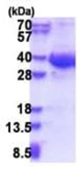 Abcam&nbsp;Recombinant Human EXOSC8 protein, 50UG