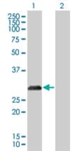Abcam&nbsp;p27 KIP 1 overexpression 293T lysate (whole cell).