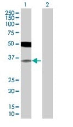 Abcam&nbsp;IRF2 overexpression 293T lysate (whole cell).