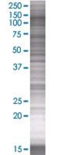 Abcam PLK4 overexpression 293T lysate (whole cell).