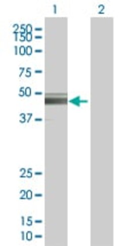 Abcam&nbsp;Tyrosinase overexpression 293T lysate (whole cell).