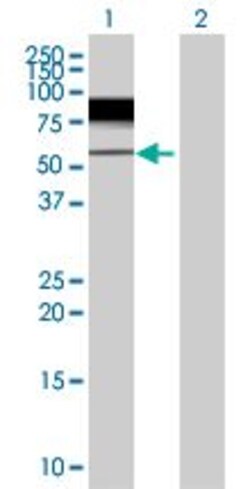 Abcam&nbsp;MeCP2 overexpression 293T lysate (whole cell).