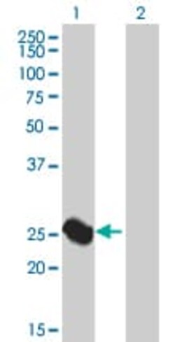 Abcam&nbsp;Liver Arginase overexpression 293T lysate (whole cell).