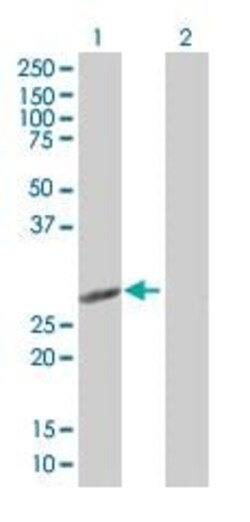Abcam&nbsp;IL-6 overexpression 293T lysate (whole cell).
