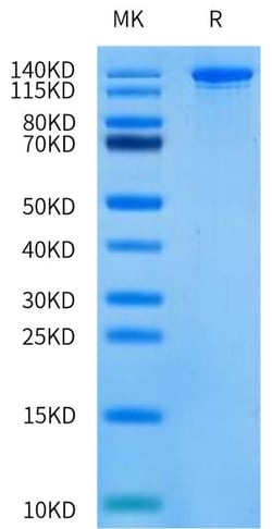 Abcam SpCas9 D10A Nickase (Active), 1MG