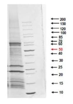 Abcam Native Helicobacter pylori antigen protein
