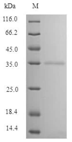 Abcam Recombinant Cow Mannan Binding Lectin/MBL protein (Tagged), 10UG