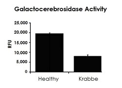 Abcam Lysosomal Galactocerebrosidase (GALC) Analysis Kit.