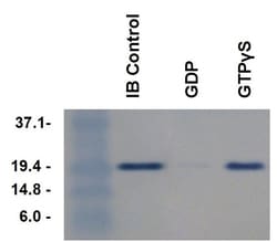 Abcam&nbsp;Rhotekin RBD Agarose Beads.