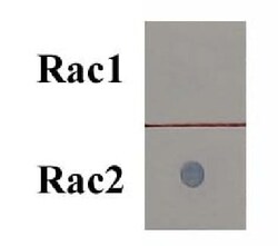 Abcam Rac2 Activation Assay Kit.