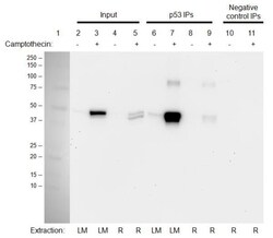 Abcam&nbsp;p53 Human Immunocapture Kit.