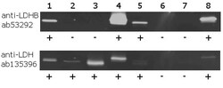 Abcam Lactate Dehydrogenase B / LDH-B Activity Assay.