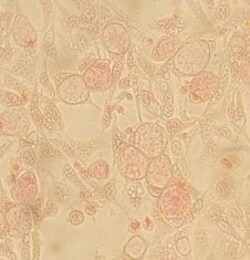 Abcam Native Chlamydia trachomatis protein, 1ML