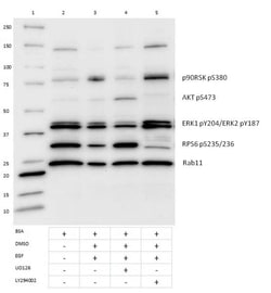 Abcam&nbsp;U0126, Selective MKK inhibitor, 1MG