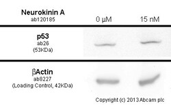 Abcam&nbsp;Neurokinin A, Tachykinin peptide, 5MG