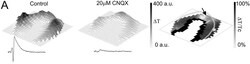 Abcam CNQ x , AMPA / kainate antagonist, 25MG