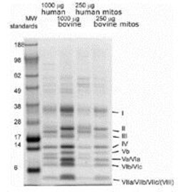Abcam Complex IV Immunocapture Kit.