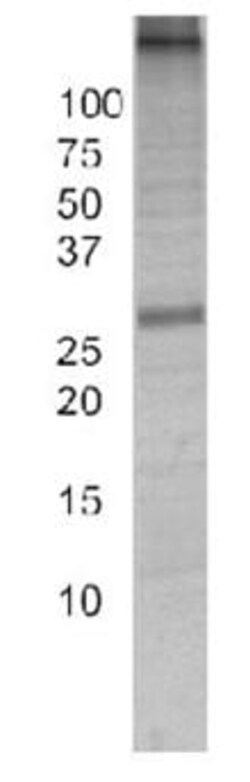 Abcam Adenine Nucleotide Translocase (ANT) Immunocapture Kit.