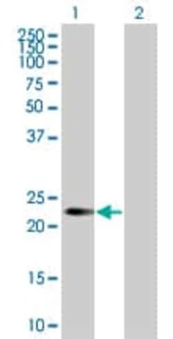 Abcam&nbsp;SNX10 overexpression 293T lysate (whole cell).
