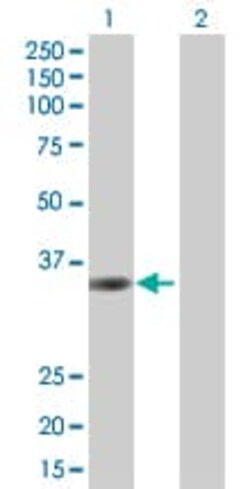 Abcam&nbsp;PL6 overexpression 293T lysate (whole cell).
