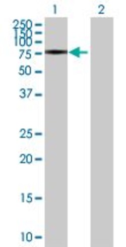Abcam&nbsp;ATG7 overexpression 293T lysate (whole cell).