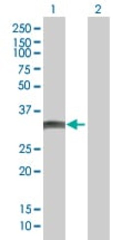 Abcam&nbsp;Bcl G/BCL2L14 overexpression 293T lysate (whole cell).