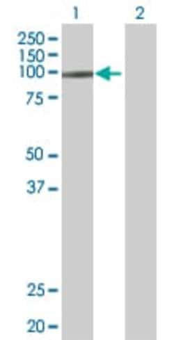 Abcam&nbsp;SMARCA6 overexpression 293T lysate (whole cell).