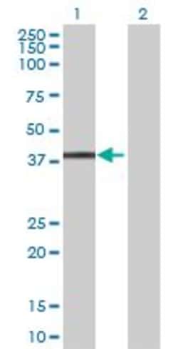 Abcam&nbsp;HspBP1 overexpression 293T lysate (whole cell).