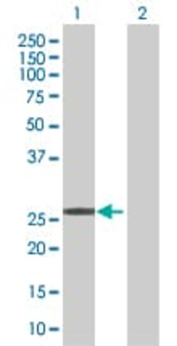 Abcam&nbsp;p27 KIP 1 overexpression 293T lysate (whole cell).