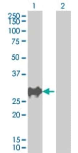 Abcam p27 KIP 1 overexpression 293T lysate (whole cell).